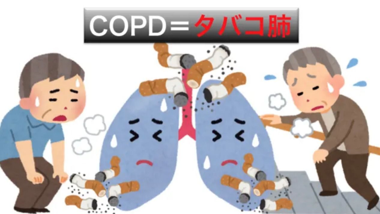 「COPD」って何? 喫煙者は「タバコ肺」に要注意(石田雅彦) - エキスパート - Yahoo!ニュース What Are The Most Common Car Maintenance Tips
